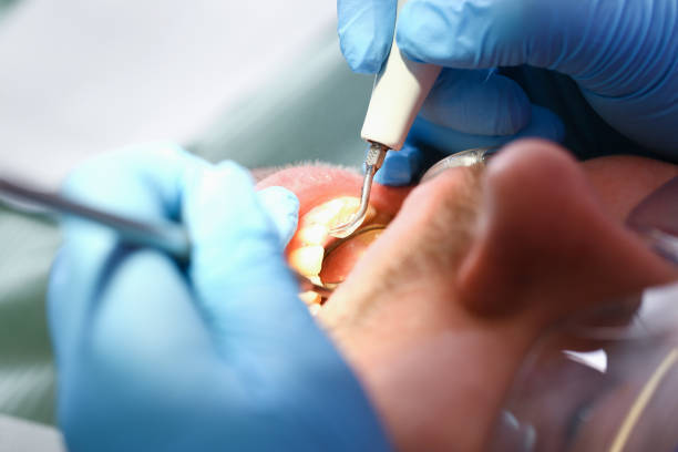 Best Knocked-Out Tooth Emergency  in Monmouth, IL