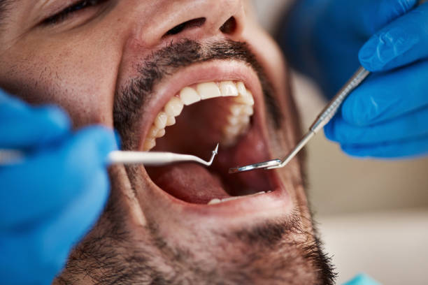 Best Broken Tooth Emergency  in Monmouth, IL